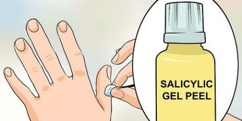 Sbarazzati delle verruche sulle dita