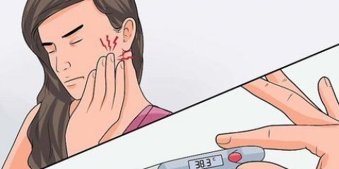 Trattare l'alveolite
