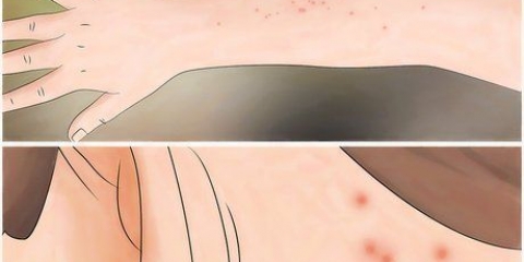 Combattere le cimici dei letti