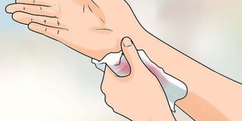 Determinare se una ferita deve essere suturata