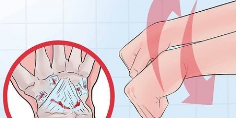 Determina se il tuo polso è slogato o rotto