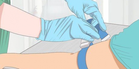 Prelievo di sangue da una vena problematica