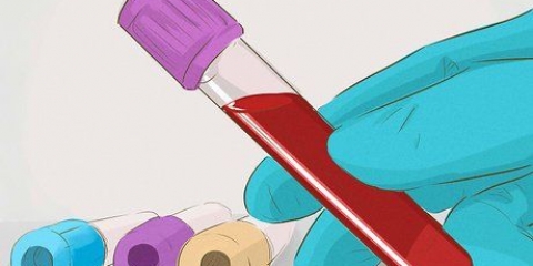 Aumento della velocità di filtrazione glomerulare