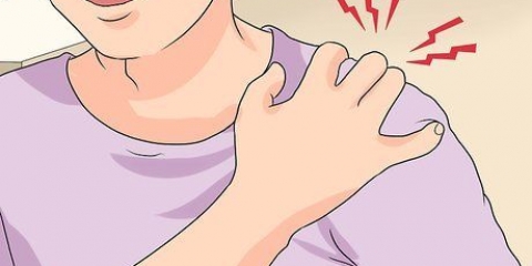Allevia il dolore di una frattura della clavicola