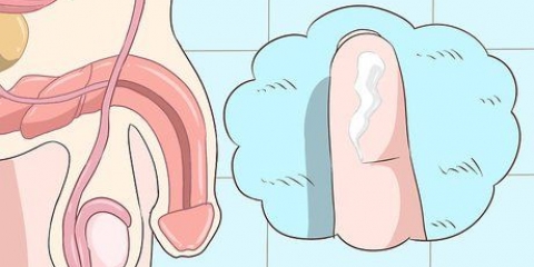 Riconoscere i sintomi della clamidia (per uomini)
