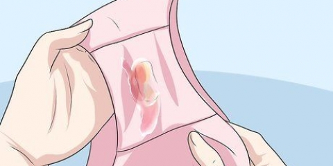 Riconoscere i sintomi della clamidia (per le donne)