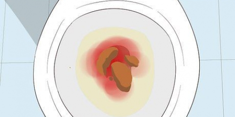 Riconoscere i sintomi del cancro al colon