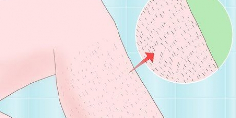 Rimuovere i peli spessi delle gambe