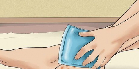 Trattamento dell'eczema disidrotico