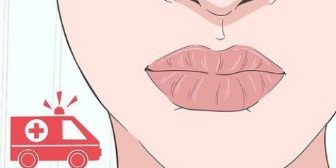 Guarisci un'ustione sulle tue labbra