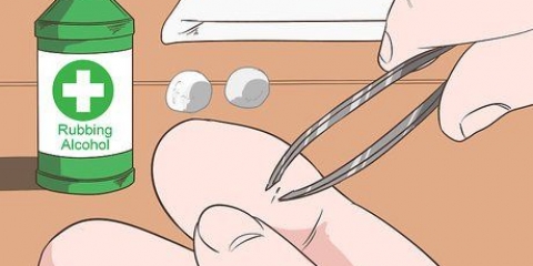 Rimozione di una scheggia profonda