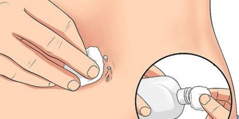 Trattare un piercing all'ombelico irritato