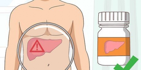 Trattamento della fosfatasi alcalina alta