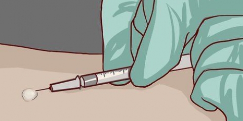 Leggere un test cutaneo per la tubercolosi