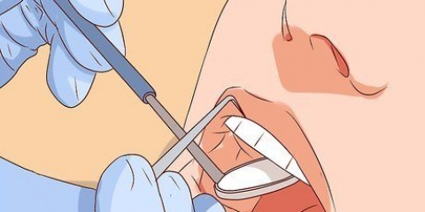 Trattare un dente sciolto