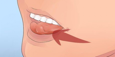 Perdere un dente sciolto senza tirarlo