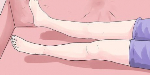 Auto-trattamento di un lieve ematoma