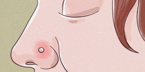 Trattare un piercing al naso infiammato