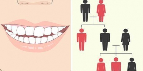 Correggi un sorriso storto