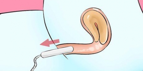 Rimuovere un tampone