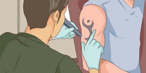 Rimuovi un tatuaggio