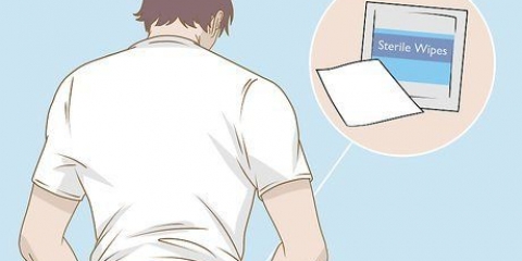 Leggere una striscia reattiva durante un'analisi delle urine