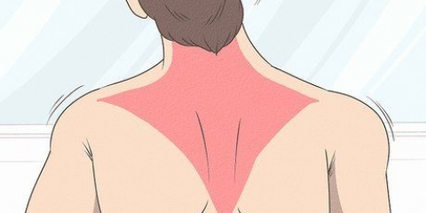 Recupero di un ceppo trapezio