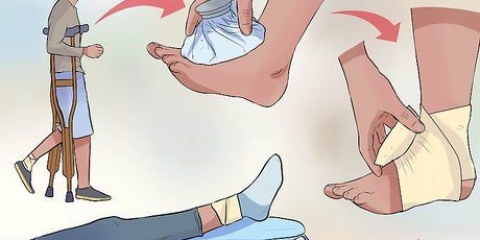 Primo soccorso per una distorsione