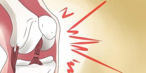 Scopri se il tuo acl è parzialmente strappato