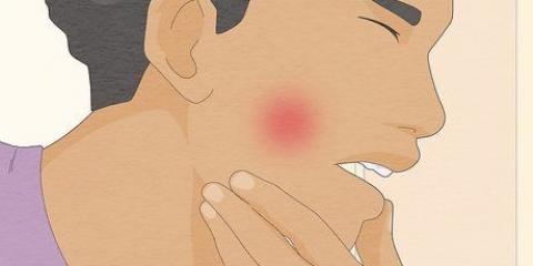 Prevenire e curare la carie nei denti