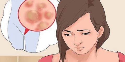 Trattamento delle verruche genitali nelle donne