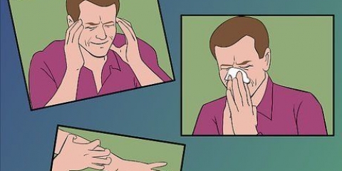Trattare l'herpes zoster