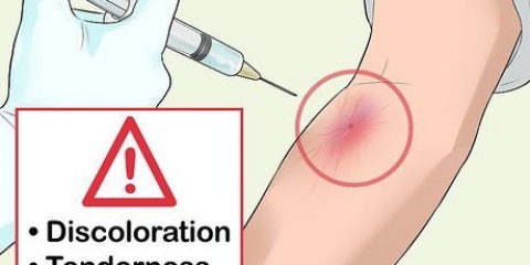 Riconosci quando una delle tue arterie è crollata