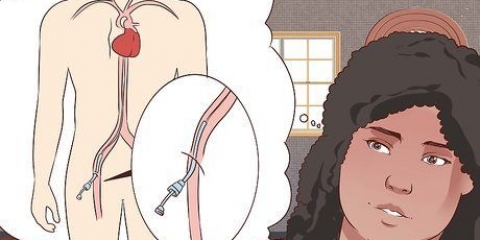 Recupero da un'angiografia