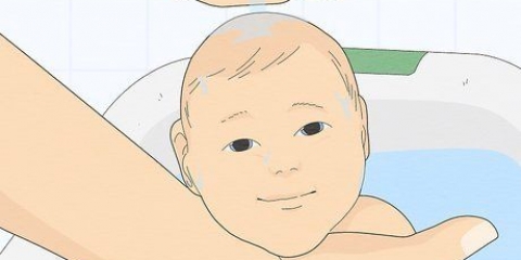 Trattare l'eruzione cutanea nei bambini