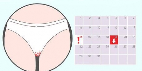 Riconoscere il sanguinamento da impianto