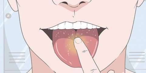 Cura la tua lingua dopo aver mangiato dolci