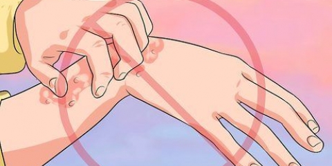 Ammorbidire il prurito con la lana di vetro
