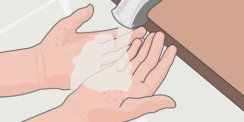 Prevenire le cicatrici