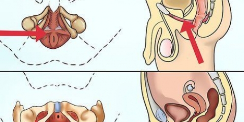 Fai esercizi per i muscoli del pavimento pelvico
