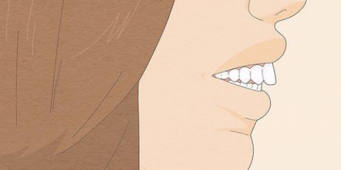 Rimedio per il morso