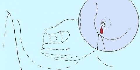 Lenisci il dolore ai capezzoli