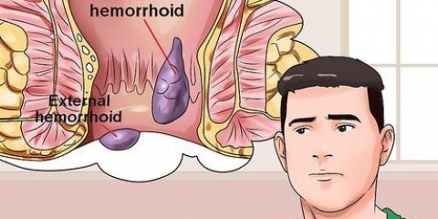 Come rimediare alle emorroidi dolorose