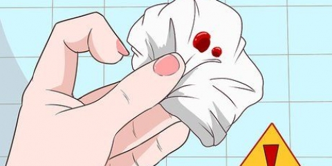 Interrompere l'emorragia rettale