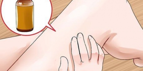 Trattare la tigna: può farlo naturalmente?