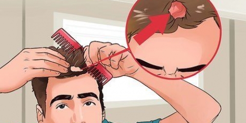 Come trattare la tigna sul cuoio capelluto