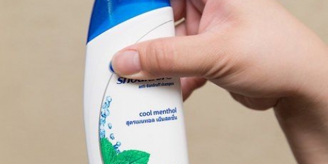 Prevenire e curare la forfora