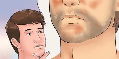 Trattamento dell'eczema seborroico sul viso
