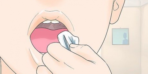 Dormire dopo la rimozione del dente del giudizio