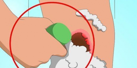 Sbarazzati rapidamente delle croste dell'acne
